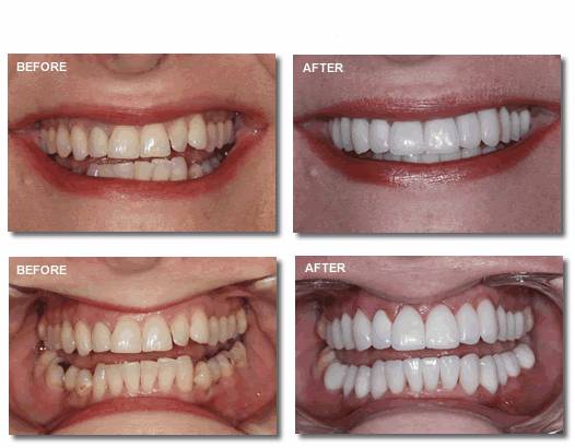 before and after photos