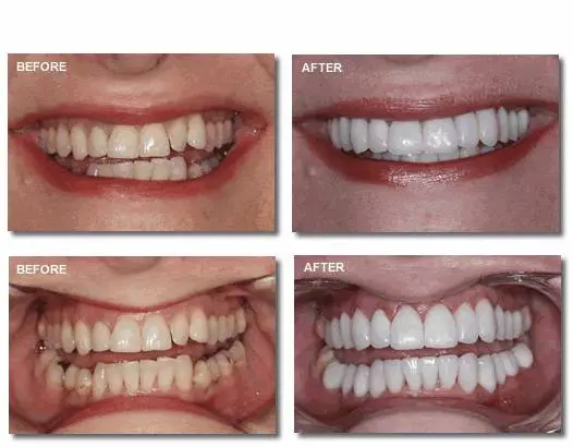 before and after photos