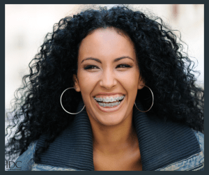 Woman with voluminous curly black hair and large hoop earrings smiles broadly, showing metal braces on upper teeth; denim jacket, neutral background